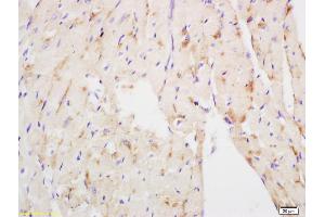Formalin-fixed and paraffin embedded mouse heart labeled with Anti NDUFS3 Polyclonal Antibody, Unconjugated (ABIN750673) at 1:200 followed by conjugation to the secondary antibody and DAB staining (NDUFS3 antibody  (AA 201-264))