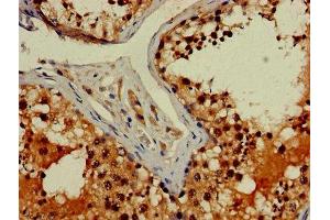 Immunohistochemistry of paraffin-embedded human testis tissue using ABIN7143007 at dilution of 1:100 (FIBP antibody  (AA 2-357))