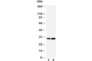 Western blot testing of LASP1 antibody and Lane 1:  HeLa;  2: MCF-7 cell lysate.