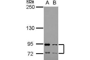 WB Image Sample (30 ug of whole cell lysate) A: Raji B: K562 5% SDS PAGE antibody diluted at 1:1000 (FCAR antibody)