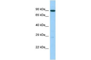 Host: Rabbit Target Name: UTP14C Sample Type: 721_B Whole Cell lysates Antibody Dilution: 1. (UTP14C antibody  (C-Term))