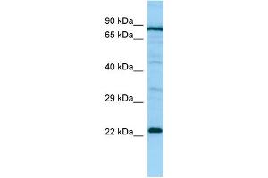 WB Suggested Anti-PTGES2 Antibody Titration: 1. (PTGES2 antibody  (Middle Region))
