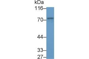 Detection of SYK in Porcine Spleen lysate using Polyclonal Antibody to Spleen Tyrosine Kinase (SYK) (SYK antibody  (AA 374-635))