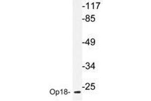 Western blot analyzes of Op18 antibody in extracts from COS-7 cells. (Stathmin 1 antibody)