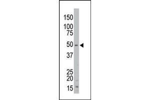 The anti-STK35 Pab (ABIN391361 and ABIN2841380) is used in Western blot to detect STK35 in mouse kidney tissue lysate. (STK35 antibody  (AA 374-404))