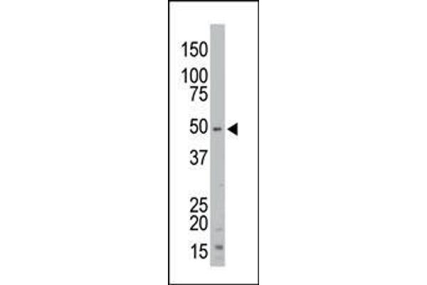 STK35 antibody  (AA 374-404)