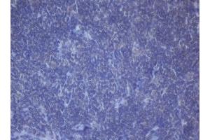 Image no. 3 for anti-DEAD (Asp-Glu-Ala-Asp) Box Polypeptide 59 (DDX59) (AA 1-303) antibody (ABIN1490728)