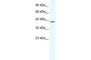 WB Suggested Anti-KCNK13 Antibody Titration:  1. (KCNK13 antibody  (C-Term))