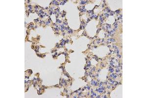 Immunohistochemistry of paraffin-embedded mouse lung using PRKACB antibody. (PRKACB antibody  (AA 1-351))