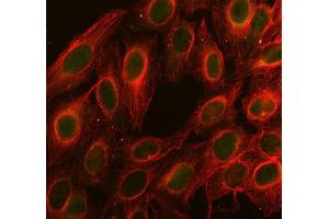 IF analysis of Cdc25C using anti-Cdc25C antibody (ABIN3042352) and anti-Tubulin Alpha antibody (ABIN7600339). (CDC25C antibody  (AA 175-473))