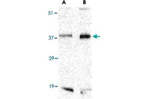 Western blot analysis of BAG1 in PC-3 cell lysate with BAG1 polyclonal antibody  at (A) 1 and (B) 2 ug/mL .