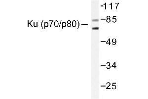 Image no. 1 for anti-X-Ray Repair Complementing Defective Repair in Chinese Hamster Cells 5 (Double-Strand-Break Rejoining) (XRCC5) antibody (ABIN265506) (XRCC5 antibody)