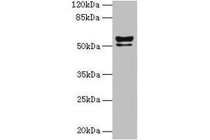 Western blot All lanes: KRT72 antibody at 2 μg/mL + MCF-7 whole cell lysate Secondary Goat polyclonal to rabbit IgG at 1/10000 dilution Predicted band size: 56, 52 kDa Observed band size: 56, 52 kDa
