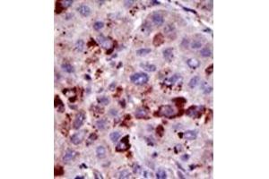 Image no. 2 for anti-Small Ubiquitin Related Modifier Protein 1 (SUMO1) antibody (ABIN356808) (SUMO1 antibody)