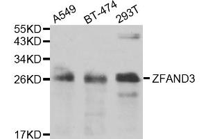 Western blot analysis of extracts of various cell lines, using ZFAND3 antibody (ABIN5975562) at 1/1000 dilution. (ZFAND3 antibody)