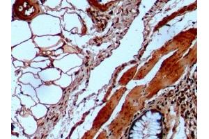 Immunohistochemistry (IHC) image for anti-Galactosidase, alpha (GLA) (AA 81-429) antibody (ABIN7426817)