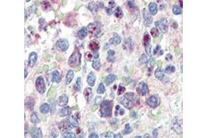 IHC analysis of FFPE human spleen tissue stained with anti-SNAIL antibody (SNAIL antibody  (AA 9-39))