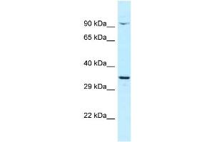 Host: Rabbit Target Name: CTNNBL1 Sample Type: OVCAR-3 Whole Cell lysates Antibody Dilution: 1. (CTNNBL1 antibody  (C-Term))