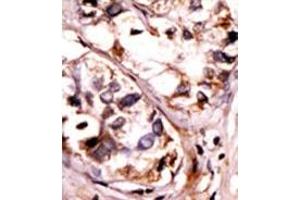 Image no. 2 for anti-Spleen tyrosine Kinase (SYK) (pTyr525), (pTyr526) antibody (ABIN358240)