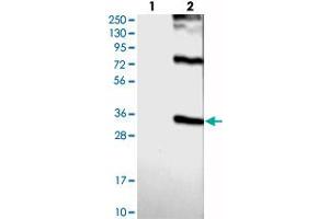Western blot analysis of Lane 1: Negative control (vector only transfected HEK293T lysate), Lane 2: Over-expression Lysate (Co-expressed with a C-terminal myc-DDK tag (~3. (BTG3 antibody)