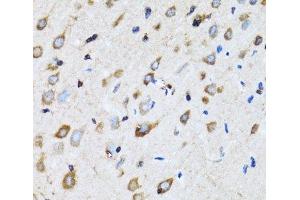 Immunohistochemistry of paraffin-embedded Rat brain using NDE1 Polyclonal Antibody at dilution of 1:100 (40x lens).