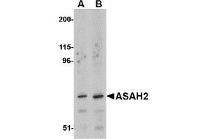 Western Blotting (WB) image for anti-N-Acylsphingosine Amidohydrolase (Non-Lysosomal Ceramidase) 2 (ASAH2) (C-Term) antibody (ABIN1030258) (ASAH2 antibody  (C-Term))