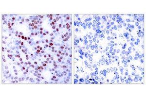 Immunohistochemistry (IHC) image for anti-Jun Proto-Oncogene (JUN) (Ser243) antibody (ABIN1848120)