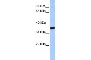 MOGAT1 antibody used at 1 ug/ml to detect target protein. (MOGAT1 antibody  (C-Term))