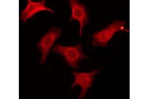 ABIN6274465 staining COLO205 by IF/ICC. (CNKSR1 antibody  (Internal Region))