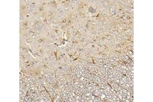 Immunohistochemistry analysis of paraffin-embedded mouse spinal cord using,CHERP (ABIN7073277) at dilution of 1: 3600 (CHERP antibody)