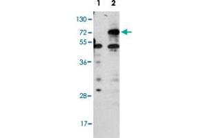 Western blot analysis of CPT1B (arrow) using rabbit CPT1B polyclonal antibody . (CPT1B antibody  (C-Term))
