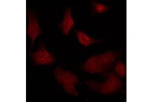 ABIN6275479 staining NIH-3T3 by IF/ICC. (RGS12 antibody  (N-Term))