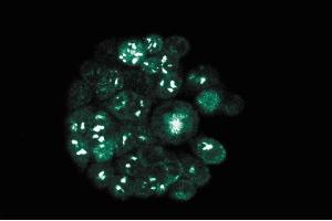 Immunofluorescence staining of WiDr cells (Human colorectal adenocarcinoma, ATCC CCL-218). (RAD23B antibody  (AA 73-193))