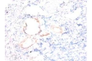 Immunohistochemistry of paraffin-embedded human kidney tissue using ABIN7143861 at dilution of 1:50 (Ensa antibody  (AA 1-121))