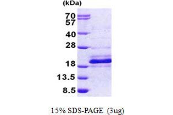 DNAJC24 Protein (AA 1-149) (His tag)