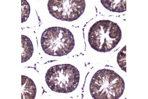 IHC testing of FFPE rat tesis tissue with WWOX antibody at 1ug/ml. (WWOX antibody)