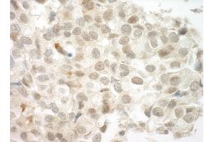 anti-Papillary Renal Cell Carcinoma (Translocation-Associated) (PRCC) (AA 125-175) antibody