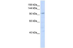 NOMO1 antibody used at 1 ug/ml to detect target protein. (NOMO1 antibody  (N-Term))