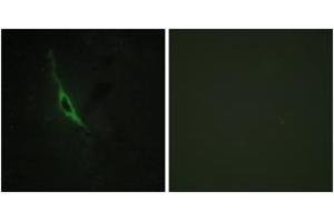 Immunofluorescence analysis of NIH-3T3 cells, using GRAK Antibody. (GZMK antibody  (AA 61-110))