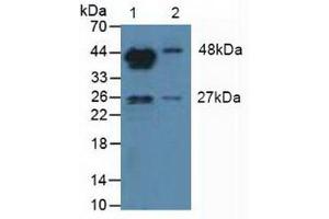 Western blot analysis of (1) Mouse Testis Tissue and (2) Mouse Placenta Tissue. (Aromatase antibody  (AA 196-373))