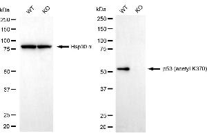 Western blotting analysis using p53 (acetyl K370) antibody (ABIN7800682). (Recombinant p53 antibody  (acLys370))