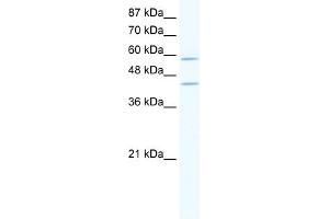 WB Suggested Anti-DCP1A Antibody Titration:  2. (DCP1A antibody  (N-Term))