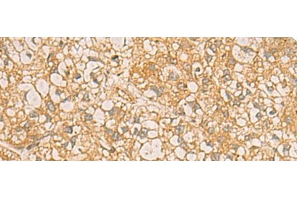 C17orf70 antibody