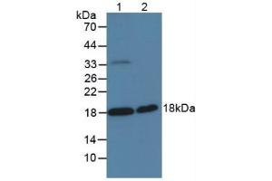 Figure. (SPINT2 antibody  (AA 28-197))