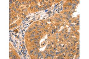 Immunohistochemistry (IHC) image for anti-Glutamate Receptor, Metabotropic 8 (GRM8) antibody (ABIN3017086) (GRM8 antibody)