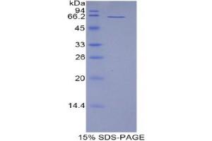 SDS-PAGE analysis of Mouse CD5L Protein.