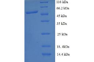 SDS-PAGE (SDS) image for Protein Interacting With Protein Kinase C, alpha 1 (PICK1) (AA 1-200), (partial) protein (GST tag) (ABIN5712409) (PICK1 Protein (AA 1-200, partial) (GST tag))