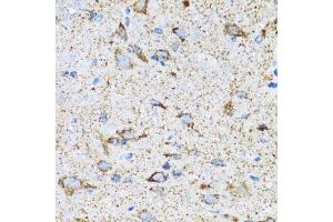 Immunohistochemistry of paraffin-embedded mouse spinal cord using HSPA9 antibody.