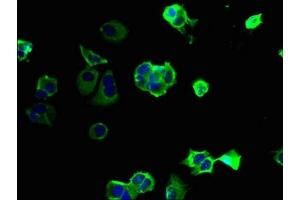 Immunofluorescent analysis of MCF-7 cells using ABIN7163824 at dilution of 1:100 and Alexa Fluor 488-congugated AffiniPure Goat Anti-Rabbit IgG(H+L) (PKD1L2 antibody  (AA 1-306))