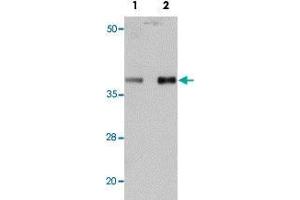 Western blot analysis of mouse heart tissue with PPAPDC3 polyclonal antibody  at (Lane 1) 1 and (Lane 2) 2 ug/mL dilution. (PPAPDC3 antibody  (N-Term))